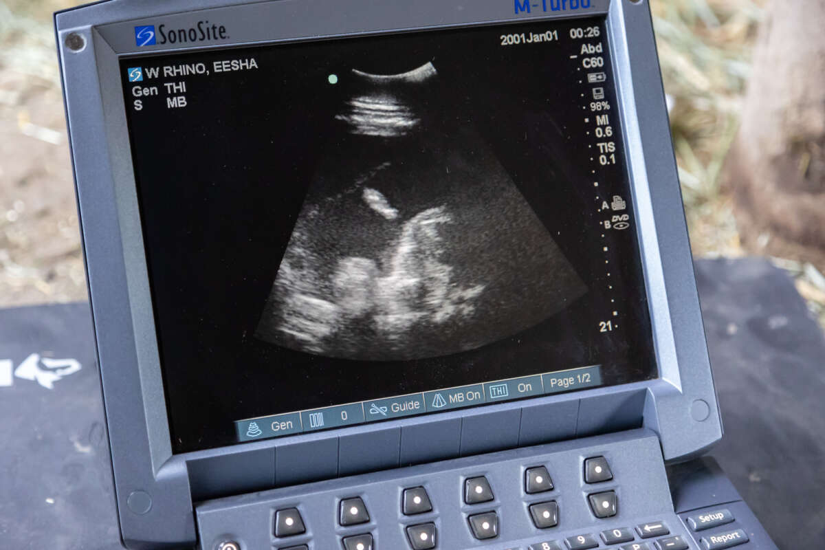 rhino ultrasound